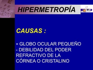 Enfermedades Oculares
HIPERMETROPÍA
CAUSAS :
- GLOBO OCULAR PEQUEÑO
- DEBILIDAD DEL PODER
REFRACTIVO DE LA
CÓRNEA O CRISTALINO
 