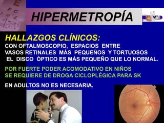Enfermedades Oculares
HIPERMETROPÍA
HALLAZGOS CLÍNICOS:
CON OFTALMOSCOPIO, ESPACIOS ENTRE
VASOS RETINALES MÁS PEQUEÑOS Y TORTUOSOS
EL DISCO ÓPTICO ES MÁS PEQUEÑO QUE LO NORMAL.
POR FUERTE PODER ACOMODATIVO EN NIÑOS
SE REQUIERE DE DROGA CICLOPLÉGICA PARA SK
EN ADULTOS NO ES NECESARIA.
 