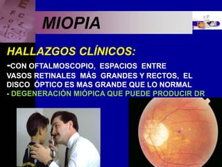 Enfermedades Oculares
MIOPIA
HALLAZGOS CLÍNICOS:
-CON OFTALMOSCOPIO, ESPACIOS ENTRE
VASOS RETINALES MÁS GRANDES Y RECTOS, EL
DISCO ÓPTICO ES MAS GRANDE QUE LO NORMAL
- DEGENERACIÓN MIÓPICA QUE PUEDE PRODUCIR DR
 
