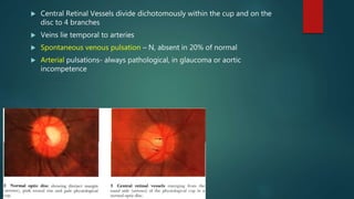  Central Retinal Vessels divide dichotomously within the cup and on the
disc to 4 branches
 Veins lie temporal to arteries
 Spontaneous venous pulsation – N, absent in 20% of normal
 Arterial pulsations- always pathological, in glaucoma or aortic
incompetence
 