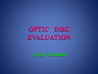 Sujay Chauhan
OPTIC DISC
EVALUATION
 