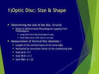 Disc Measurement Comprehensive Optic Disc Assessment for Glaucoma Diagnosis and ...