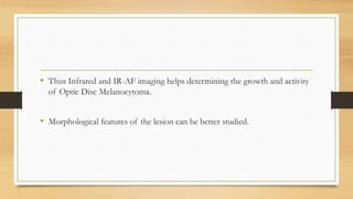 • Thus Infrared and IR-AF imaging helps determining the growth and activity
of Optic Disc Melanocytoma.
• Morphological features of the lesion can be better studied.
 
