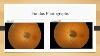 Fundus Photographs
May 2015 October 2017
 
