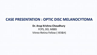 CASE PRESENTATION : OPTIC DISC MELANOCYTOMA
Dr. Arup Krishna Choudhury
FCPS, DO, MBBS
Vitreo-Retina Fellow ( IIEI&H)
 