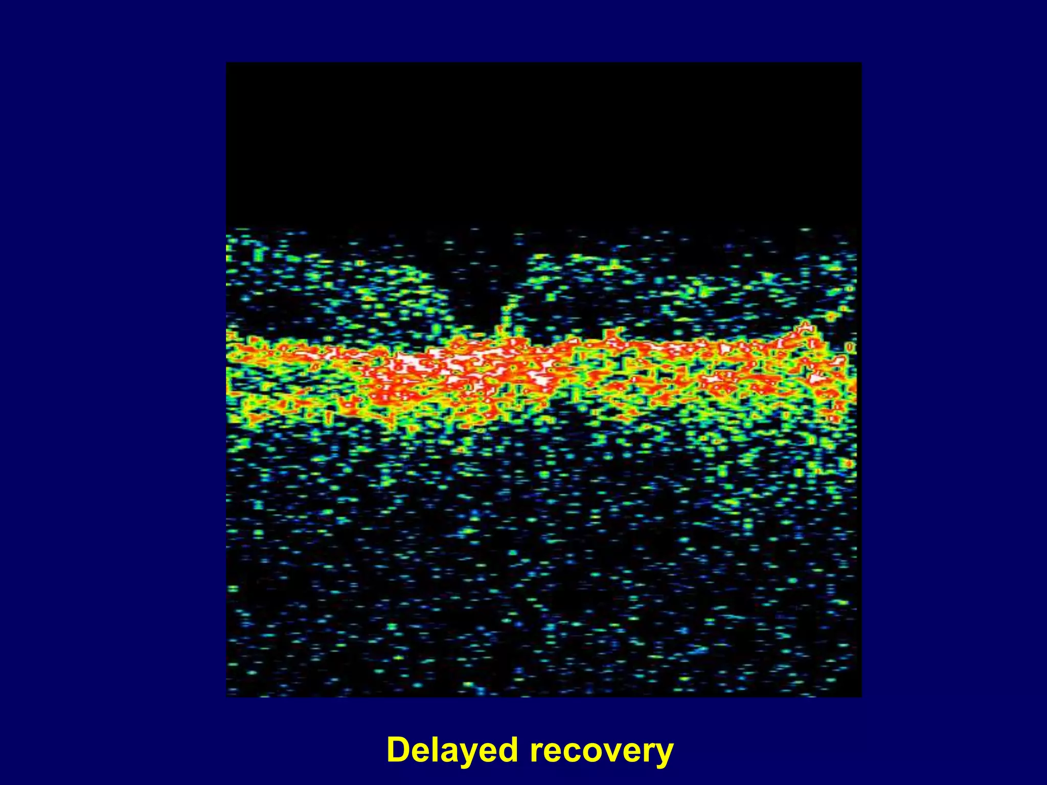 Optic disc pit pathogenesis and management ppt