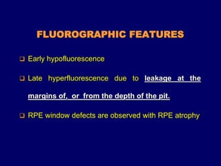 FLUOROGRAPHIC FEATURES
 Early hypofluorescence
 Late hyperfluorescence due to leakage at the
margins of, or from the depth of the pit.
 RPE window defects are observed with RPE atrophy
 