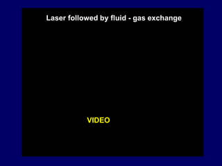 VIDEO
Laser followed by fluid - gas exchange
 