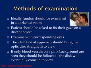 Optic fundus in clinical medicine | PDF