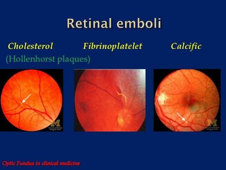 Optic fundus in clinical medicine
