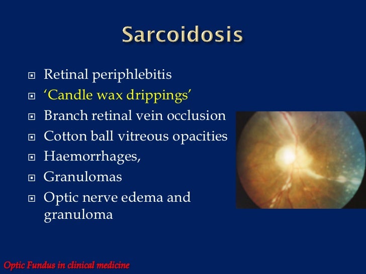 Optic fundus in clinical medicine