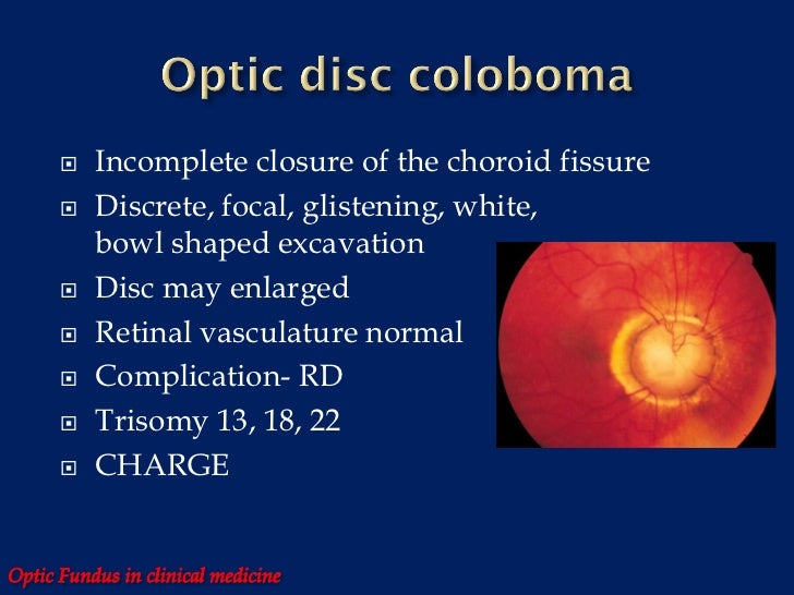 Optic fundus in clinical medicine