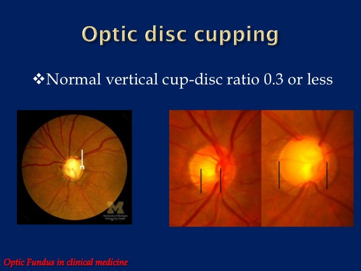 Optic fundus in clinical medicine