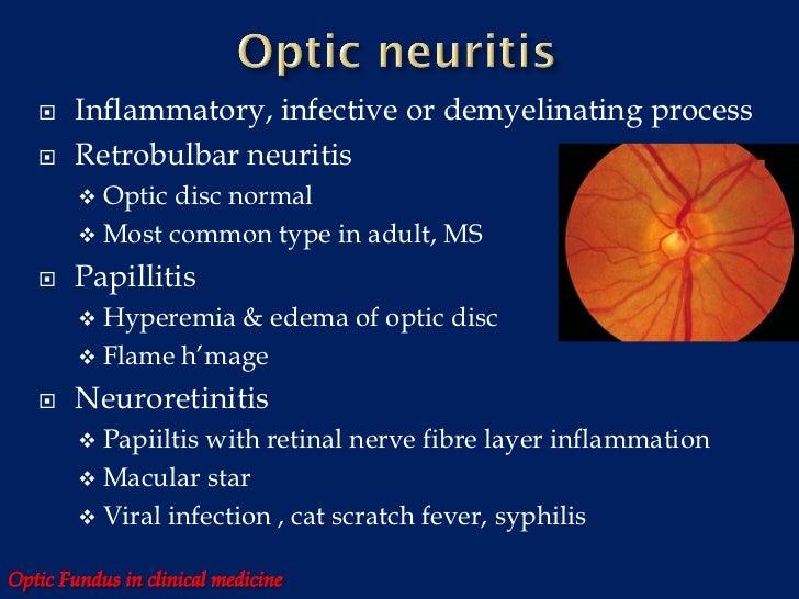 Optic fundus in clinical medicine