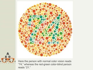 Normal Color Vision Patient The Eye - Physiology of vision in human | PPTX
