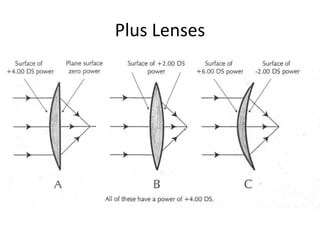 Plus Lens Example Optic, lens and iol | PPTX