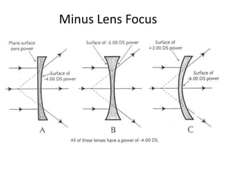 Optic, lens and iol