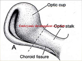 Optic nerve and its disorders | PPTX