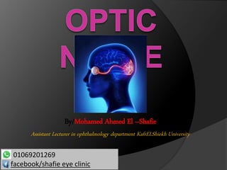 01069201269
facebook/shafie eye clinic
By/Mohamed Ahmed El –Shafie
Assistant Lecturer in ophthalmology department KafrELShiekh University
 