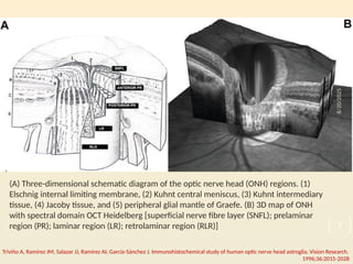 Optic Nerve Head Evaluation for glaucoma | PPTX