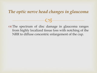Optic nerve head evaluation in glaucoma | PPTX