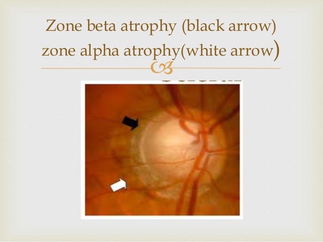 Alpha black vs beta white 9