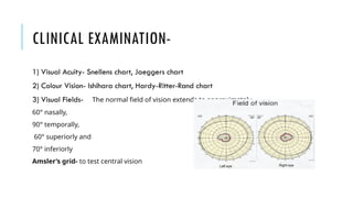 Handy Hand Ritter Vision Test Comprehensive Overview of Optic Nerve Anatomy, Pathology, and Imaging ...