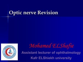 Optic nerve Revision
Mohamed ELShafie
Assistant lecturer of ophthalmology
Kafr ELShiekh university
 