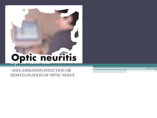 Optic neuritis
=INFLAMMATION,INFECTION OR
DEMYELINATION OF OPTIC NERVE
 