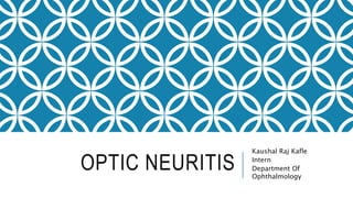 OPTIC NEURITIS
Kaushal Raj Kafle
Intern
Department Of
Ophthalmology
 