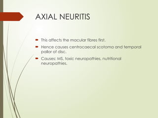 Optic Neuritis and it' s management.pptx