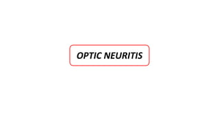 OPTIC NEURITIS
 