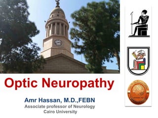 Amr Hassan, M.D.,FEBN
Associate professor of Neurology
Cairo University
Optic Neuropathy
 