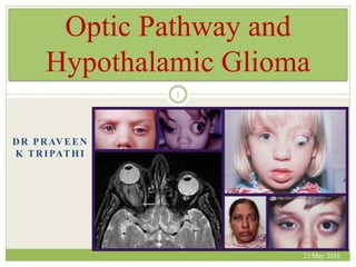 DR PRAVEEN
K TRIPATHI
Optic Pathway and
Hypothalamic Glioma
23 May 2016
1
 