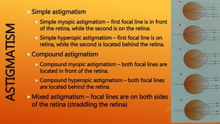 Optics of ametropia | PPTX