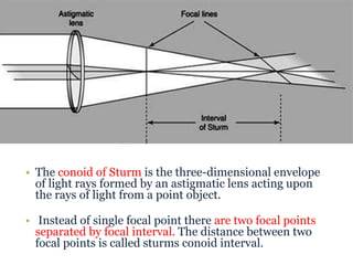 Optics of ametropia | PPTX