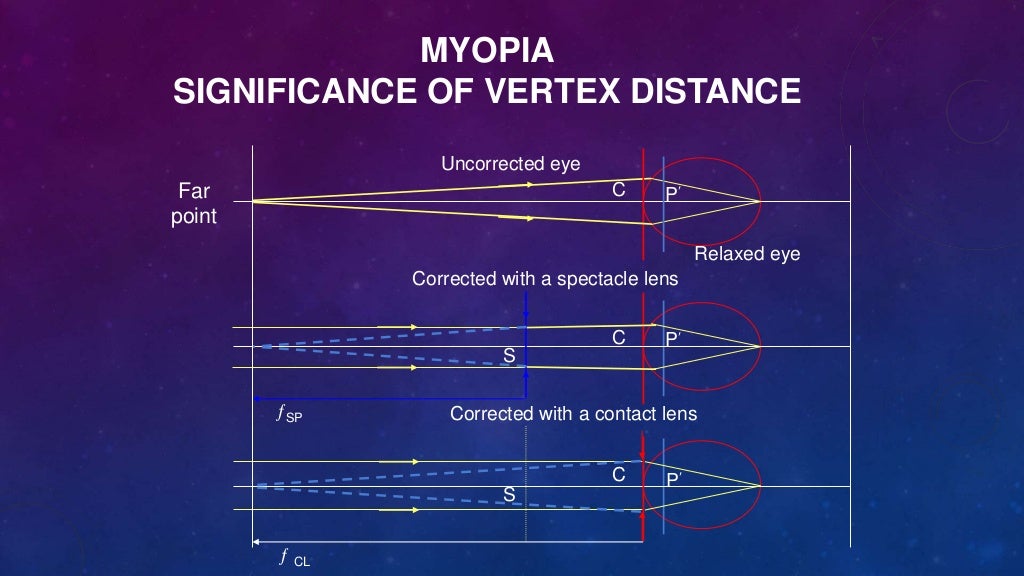 OPTICS OF CONTACT LENSES