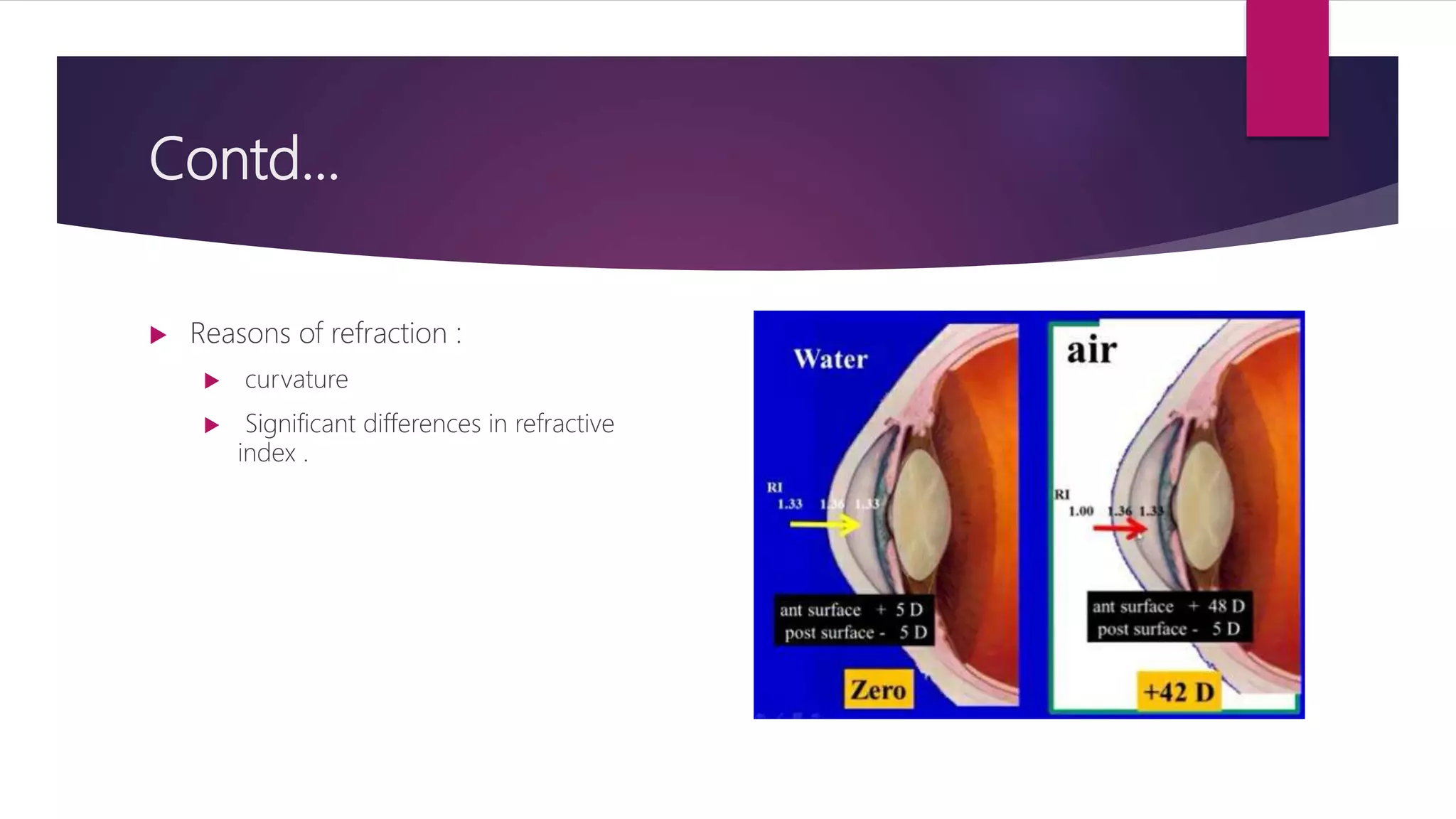Contd...
 Reasons of refraction :
 curvature
 Significant differences in refractive
index .
 
