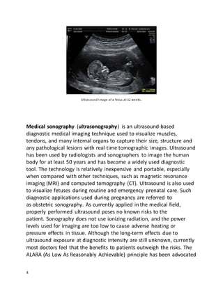 4
Ultrasound image of a fetus at 12 weeks.
Medical sonography (ultrasonography) is an ultrasound-based
diagnostic medical imaging technique used to visualize muscles,
tendons, and many internal organs to capture their size, structure and
any pathological lesions with real time tomographic images. Ultrasound
has been used by radiologists and sonographers to image the human
body for at least 50 years and has become a widely used diagnostic
tool. The technology is relatively inexpensive and portable, especially
when compared with other techniques, such as magnetic resonance
imaging (MRI) and computed tomography (CT). Ultrasound is also used
to visualize fetuses during routine and emergency prenatal care. Such
diagnostic applications used during pregnancy are referred to
as obstetric sonography. As currently applied in the medical field,
properly performed ultrasound poses no known risks to the
patient. Sonography does not use ionizing radiation, and the power
levels used for imaging are too low to cause adverse heating or
pressure effects in tissue. Although the long-term effects due to
ultrasound exposure at diagnostic intensity are still unknown, currently
most doctors feel that the benefits to patients outweigh the risks. The
ALARA (As Low As Reasonably Achievable) principle has been advocated
 