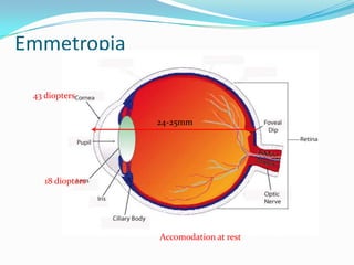 Emmetropia
24-25mm
43 diopters
18 diopters
Accomodation at rest
 