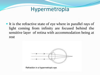 Hypermetropia
 It is the refractive state of eye where in parallel rays of
light coming from infinity are focused behind the
sensitive layer of retina with accommodation being at
rest
 