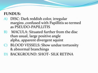 FUNDUS:
A) DISC: Dark reddish color, irregular
margins ,confused with Papillitis so termed
as PSEUDO-PAPILLITIS
B) MACULA: Situated further from the disc
than usual, large positive angle
alpha, apparent divergent squint
C) BLOOD VESSELS: Show undue tortuosity
& abnormal branchings
D) BACKGROUND: SHOT- SILK RETINA
 