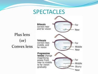 SPECTACLES
Plus lens
(or)
Convex lens
 