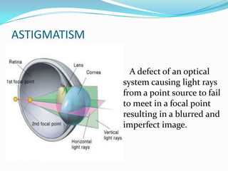 ASTIGMATISM
A defect of an optical
system causing light rays
from a point source to fail
to meet in a focal point
resulting in a blurred and
imperfect image.
 