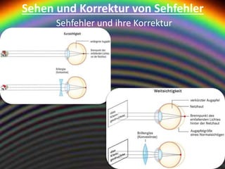 Sehen und Korrektur von Sehfehler
Sehfehler und ihre Korrektur
 