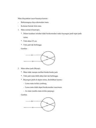 Mata dinyatakan cacat biasanya karena : 
- Berkurangnya daya akomodasi mata. 
- Kelainan bentuk bola mata. 
1. Mata normal (Emetropi). 
*. Dalam keadaan istirahat tidak berakomodasi maka bayangan jatuh tepat pada 
retina. 
*. Titik dekat 25 cm. 
*. Titik jauh tak berhingga. 
Gambar : 
2. Mata rabun jauh (Myopi). 
*. Mata tidak mampu melihat benda-benda jauh. 
*. Titik jauh mata lebih dekat dari tak berhingga. 
*. Bayangan jatuh di depan retina, disebabkan karena : 
- Lensa mata terlalu cembung. 
- Lensa mata tidak dapat berakomodasi maximum. 
- As mata (sumbu mata terlalu panjang). 
Gambar. 
 