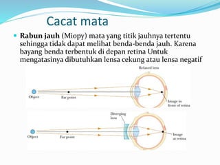 Cacat mata
 Rabun jauh (Miopy) mata yang titik jauhnya tertentu
sehingga tidak dapat melihat benda-benda jauh. Karena
bayang benda terbentuk di depan retina Untuk
mengatasinya dibutuhkan lensa cekung atau lensa negatif
 