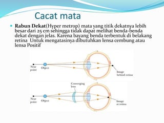 Cacat mata
 Rabun Dekat(Hyper metrop) mata yang titik dekatnya lebih
besar dari 25 cm sehingga tidak dapat melihat benda-benda
dekat dengan jelas. Karena bayang benda terbentuk di belakang
retina Untuk mengatasinya dibutuhkan lensa cembung atau
lensa Positif
 
