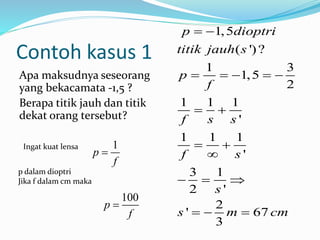 Contoh kasus 1
Apa maksudnya seseorang
yang bekacamata -1,5 ?
Berapa titik jauh dan titik
dekat orang tersebut?
1,5
( ')?
1 3
1,5
2
1 1 1
'
1 1 1
'
3 1
2 '
2
' 67
3
p dioptri
titik jauh s
p
f
f s s
f s
s
s m cm
 
    
 
 

  
  
Ingat kuat lensa 1
p
f

p dalam dioptri
Jika f dalam cm maka
100
p
f

 
