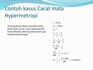 Contoh kasus Cacat mata
Hypermetropi
25
' 40
?
1 1 1
'
1 1 1
25 40
4 2,5 1
100
1,5 1
?
100
1 1,5 100
1,5
100
s cm
s cm
p
s s f
f
f
p
f
p dioptri
f

 

 
 


  

   
Seorang hanya dapat membaca jelas
pada jarak 40 cm. cacat mata apa dan
harus dibantu oleh kacamata jenis apa
berkekuatan berapa?
 